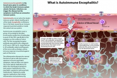 What is Autoimmune Encephalitis?