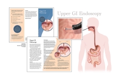 Endoscopy