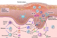 Psoriasis-moa