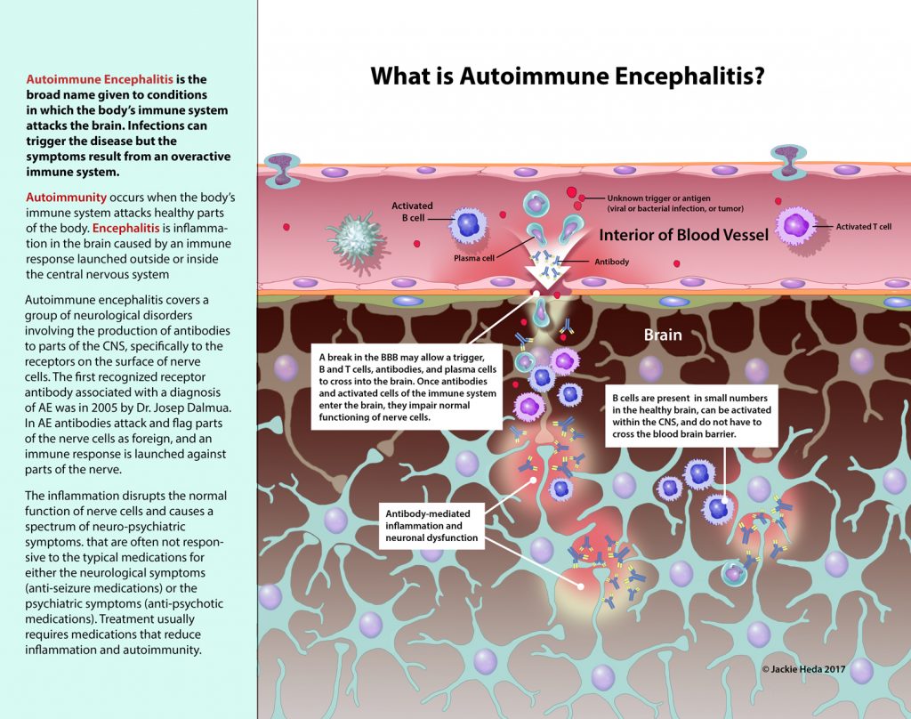 What Is Autoimmune Encephalitis Jackie Heda Biomedical And Scientific Visuals 9274